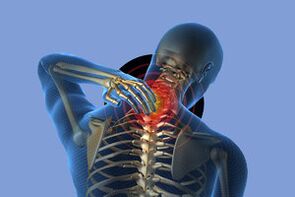 Mga Sintomas sa Cervical Osteochondrosis