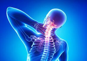 Mga timailhan sa cervical osteochondrosis