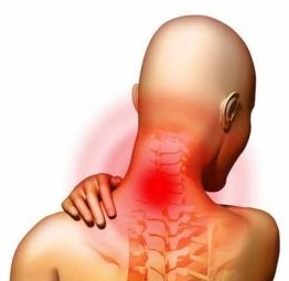 Osteochondrosis sa cervical spine