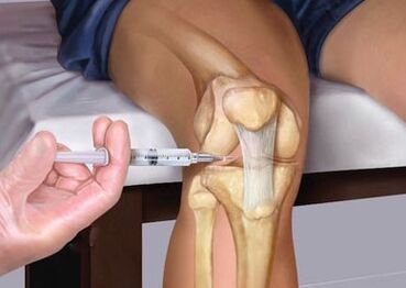 Injection sa hiniusa