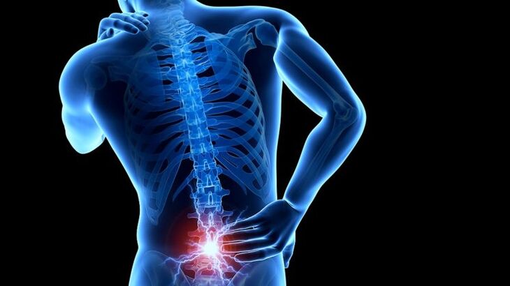 sakit sa likod nga adunay lumbar osteochondrosis